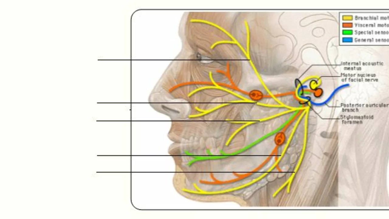 Estimulação do Nervo Vago para Convulsões Parciais de Início: O que Você Precisa Saber
